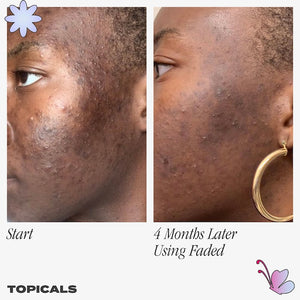 Topicals Faded Serum for Dark Spots & Discoloration