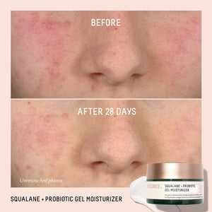 Biossance Squalane + Probiotic Gel Moisturizer